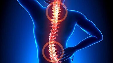 osteokondrosia garatzeko mekanismoa