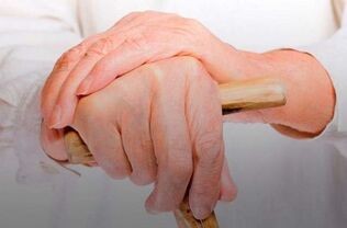 behatzen artikulazioetako mina artritis erreumatoidearekin