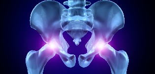 artrosia hip joint